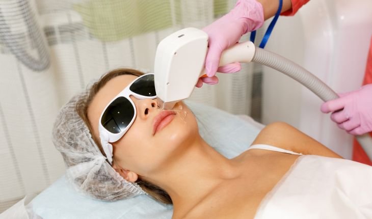 Laser treatment